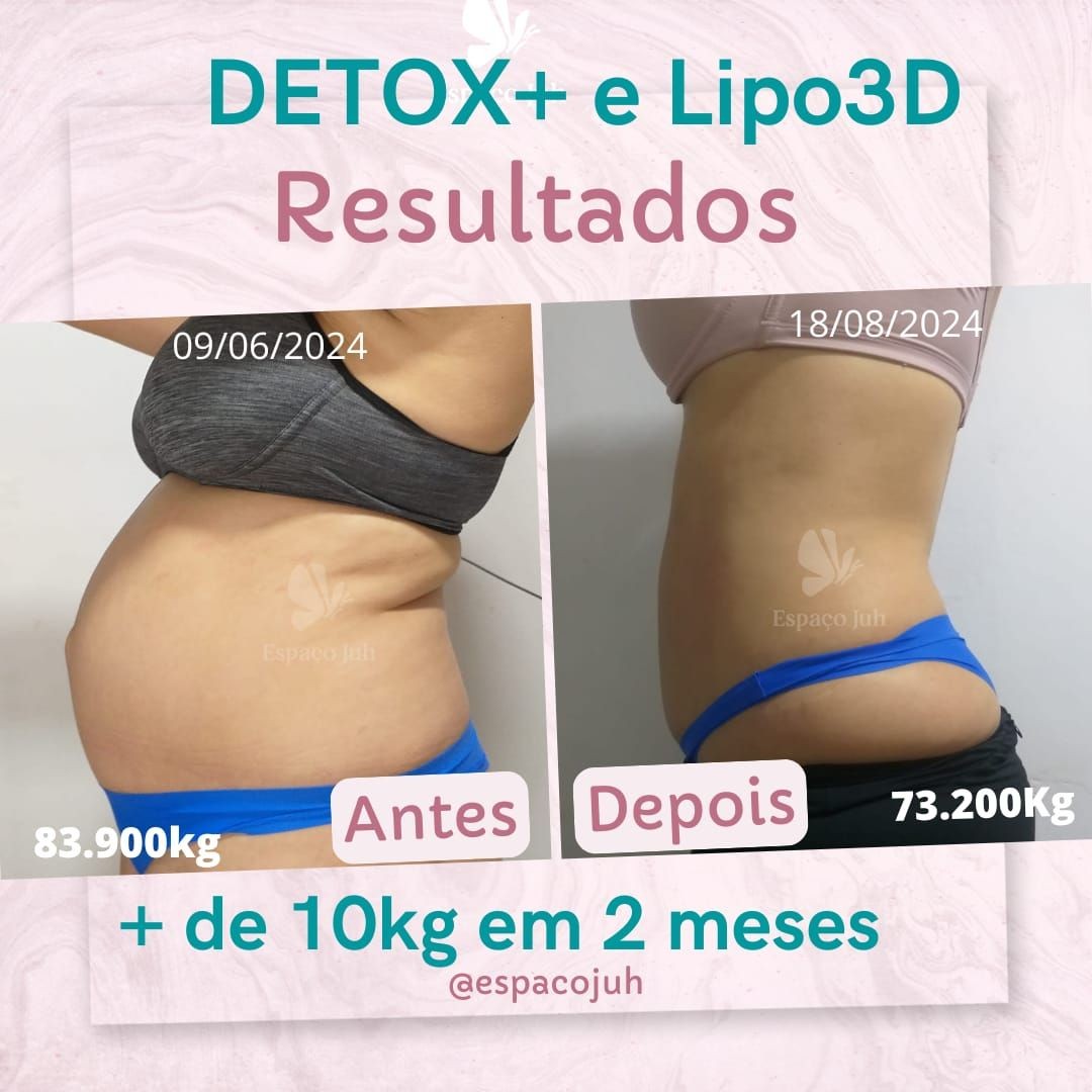 Before and after photos showing weight loss with Detox+ and Lipo3D results in Portuguese.